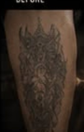 Tattoo vorher